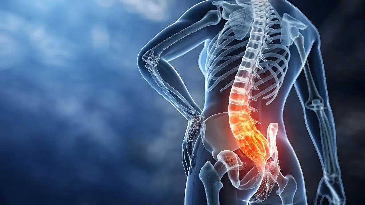 Fisioterapeuta tratando el dolor de espalda en ADH Clínica