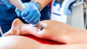 Ondas de choque: qué son, para qué lesiones sirven y cuándo no