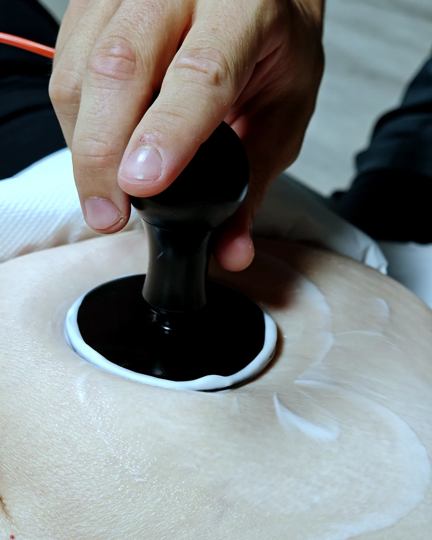 Diatermia aplicada en la rodilla en ADH Clinic