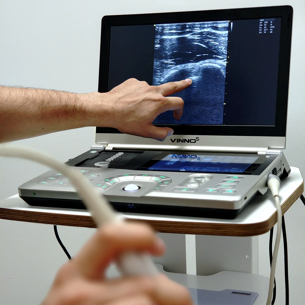 Imagen ecográfica de hombro en el ecógrafo de ADH Clinic
