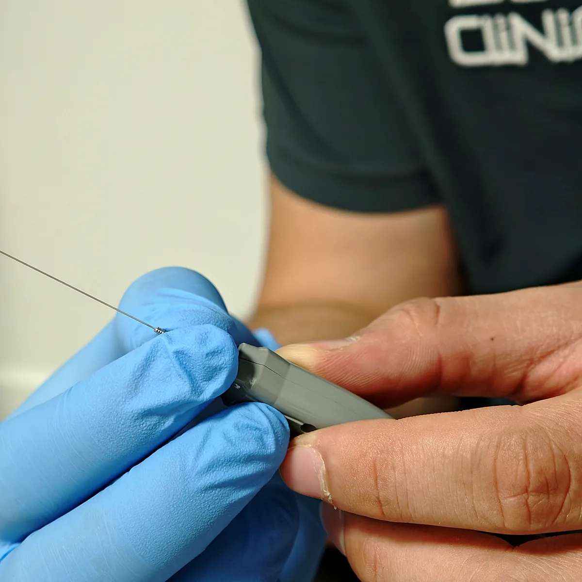 Electrólisis percutánea intratisular ecoguiada en el codo, en ADH Clinic