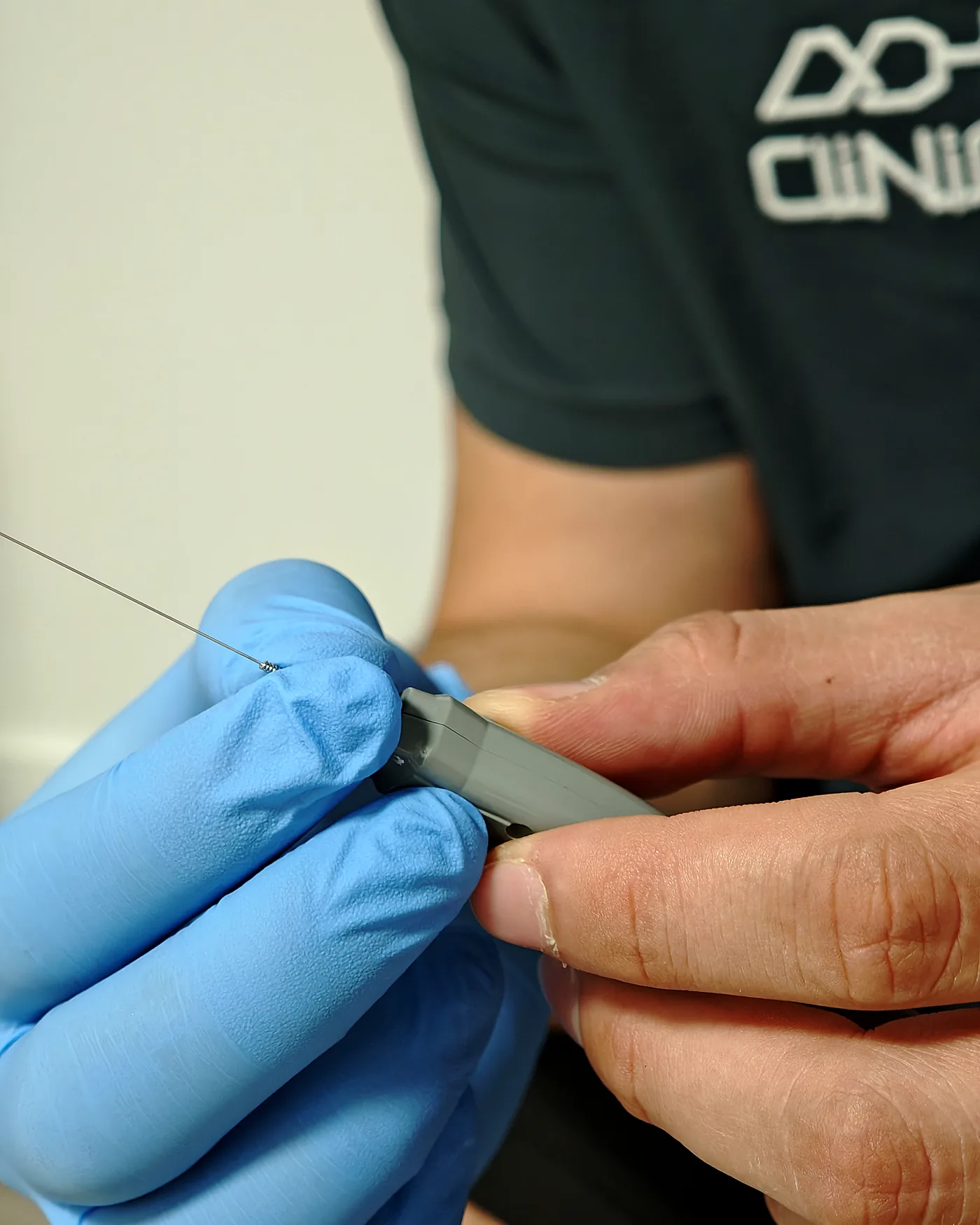Electrólisis percutánea (EPI) ecoguiada en codo, ADH Clinic