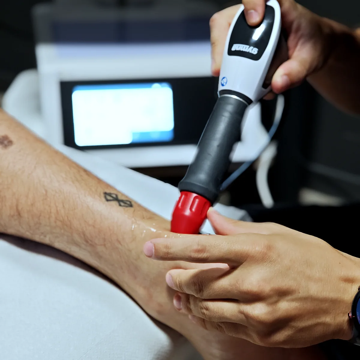 Aplicador de ondas de choque sobre la pierna en ADH Clinic