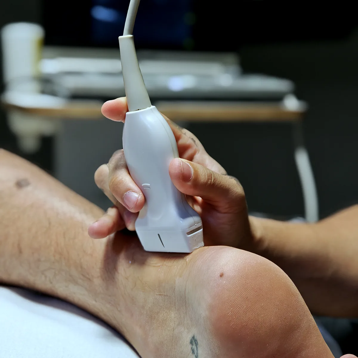 Ecografía de tobillo en fisioterapia deportiva en A Coruña: sonda sobre el tobillo de un deportista en ADH Clinic